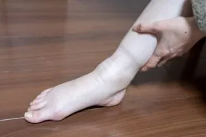 【むくみのしくみ】４つのおうちで簡単ケア【在宅介護】